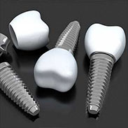 Dental Implants in Scarsdale, NY