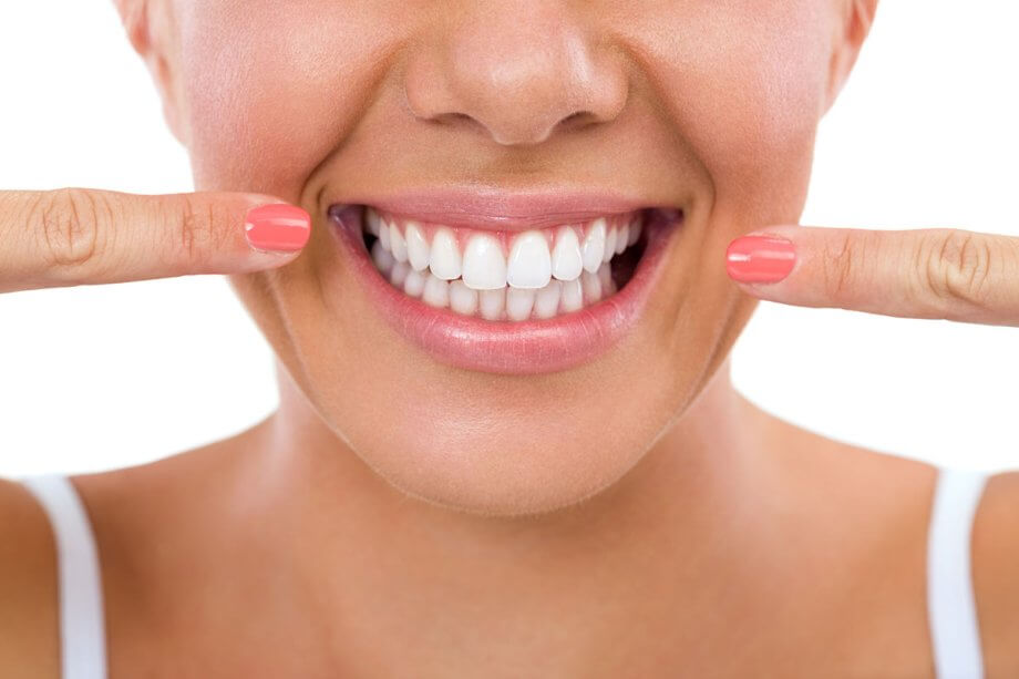 What is the Cost of Professional Teeth Whitening in Scarsdale, NY